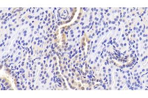 Detection of RANk in Human Kidney Tissue using Polyclonal Antibody to Receptor Activator Of Nuclear Factor Kappa B (RANk)