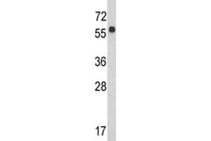 Western blot analysis of WDR1 antibody and CEM lysate.