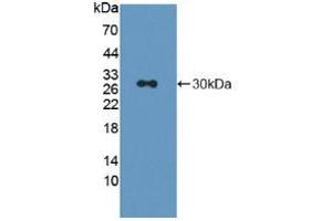 Figure. (LAG3 anticorps  (AA 209-451))