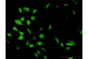 Immunofluorescence of purified MaxPab antibody to CISH on HeLa cell.