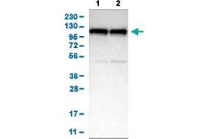Western Blot analysis of (1) human cell line RT-4, and (2) human cell line U-251MG sp.