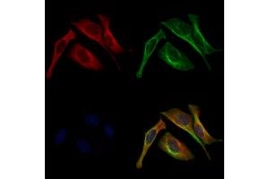 ABIN6262030 and ABIN6272943 staining 3 by IF/ICC.