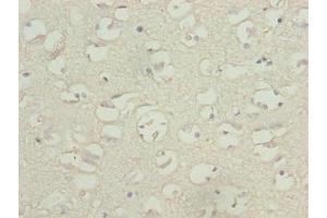 Immunohistochemistry of paraffin-embedded human brain tissue using ABIN7171598 at dilution of 1:100 (TBC1D14 anticorps  (AA 136-435))