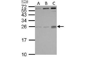 WB Image PLGF antibody detects PGF protein by Western blot analysis. (PLGF anticorps)