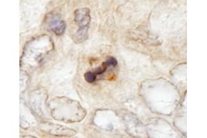 Immunohistochemistry (IHC) image for anti-Centromere Protein F (CENPF) (AA 2350-2400) antibody (ABIN7448938) (CENPF anticorps  (AA 2350-2400))