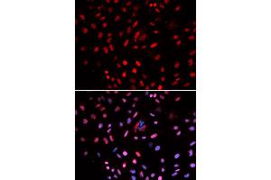 Immunofluorescence analysis of U2OS cells using POLD1 antibody. (POLD1 anticorps)