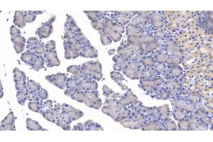 Detection of MYH11 in Rat Pancreas Tissue using Polyclonal Antibody to Myosin Heavy Chain 11, Smooth Muscle (MYH11) (MYH11 anticorps  (AA 1-351))