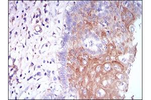 Immunohistochemical analysis of paraffin-embedded esophageal tissues using CSF1R mouse mAb with DAB staining. (CSF1R anticorps  (AA 344-497))