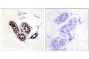 Immunohistochemistry (IHC) image for anti-Microphthalmia-Associated Transcription Factor (MITF) (Ser180), (Ser73) antibody (ABIN1847958) (MITF anticorps  (Ser73, Ser180))