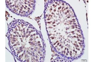 Paraformaldehyde-fixed, paraffin embedded rat testis, Antigen retrieval by boiling in sodium citrate buffer (pH6) for 15min, Block endogenous peroxidase by 3% hydrogen peroxide for 30 minutes, Blocking buffer (normal goat serum) at 37°C for 20min, Antibody incubation with Mitofusin 1 Polyclonal Antibody, Unconjugated  at 1:400 overnight at 4°C, followed by a conjugated secondary for 20 minutes and DAB staining. (MFN1 anticorps  (AA 651-741))