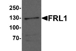 Western Blotting (WB) image for anti-Formin-Like 1 (FMNL1) (C-Term) antibody (ABIN1077402)