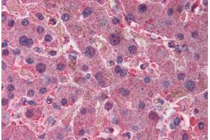 Human Liver (formalin-fixed, paraffin-embedded) stained with AHSG antibody ABIN291878 at 2. (Fetuin A anticorps)