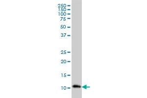 RPA3 monoclonal antibody (M01), clone 1F4 Western Blot analysis of RPA3 expression in HL-60 .