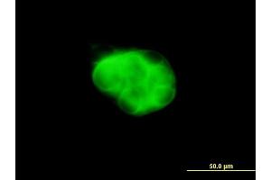 Immunofluorescence of monoclonal antibody to DCAKD on MCF-7 cell.
