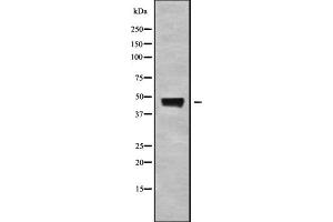 Western blot analysis ABHD3 using K562 whole cell lysates. (ABHD3 anticorps)