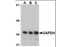 Western Blotting (WB) image for anti-Glyceraldehyde-3-Phosphate Dehydrogenase (GAPDH) (N-Term) antibody (ABIN2473761) (GAPDH anticorps  (N-Term))