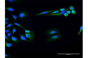 Immunofluorescence of purified MaxPab antibody to FUK on HeLa cell. (FUK anticorps  (AA 1-1084))