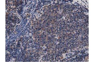 Immunohistochemical staining of paraffin-embedded Human colon tissue using anti-DNAJA2 mouse monoclonal antibody. (DNAJA2 anticorps)