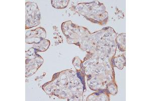 Immunohistochemistry of paraffin-embedded human placenta using PI3 Kinase p85 beta antibody (ABIN7269320) at dilution of 1:200 (40x lens).