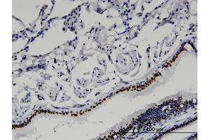 Immunoperoxidase of monoclonal antibody to BAZ2B on formalin-fixed paraffin-embedded human lung.