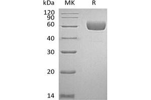 Western Blotting (WB) image for Serpin Family A Member 7 (SERPINA7) protein (His tag) (ABIN7319792)