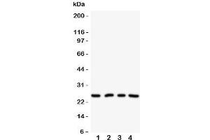 Western blot testing of NPM2 antibody on Lane 1: HeLa;  2: U87;  3: A549;  4: SMMC-7721 cell lysate.