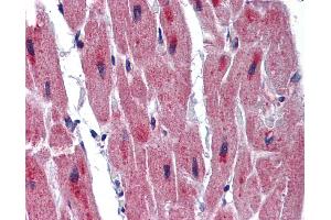 Immunohistochemistry (IHC) image for anti-RNA Binding Motif Protein 24 (RBM24) (Middle Region) antibody (ABIN2776655)