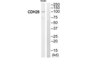 Western blot analysis of extracts from HuvEc cells, using Cytochrome P450 2C8 antiobdy. (CYP2C8 anticorps)