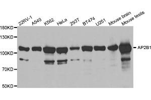 Western blot analysis of extracts of various cell lines, using AP2B1 antibody (ABIN5971039) at 1/1000 dilution. (AP2B1 anticorps)