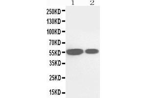 Anti-Cytochrome P450 2E1 antibody, Western blotting Lane 1: Rat Liver Tissue Lysate Lane 2: Mouse Liver Tissue Lysate (CYP2E1 anticorps  (N-Term))