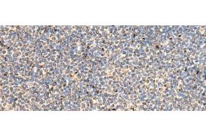 Immunohistochemistry of paraffin-embedded Human tonsil tissue using PTH1R Polyclonal Antibody at dilution of 1:65(x200)