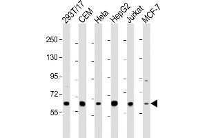 All lanes : Anti-RNF31 Antibody (C-term) at 1:2000 dilution Lane 1: 293T/17 whole cell lysate Lane 2: CEM whole cell lysate Lane 3: Hela whole cell lysate Lane 4: HepG2 whole cell lysate Lane 5: Jurkat whole cell lysate Lane 6: MCF-7 whole cell lysate Lysates/proteins at 20 μg per lane.