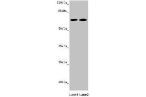 Western blot All lanes: STXBP2 antibody at 5. (STXBP2 anticorps  (AA 1-280))