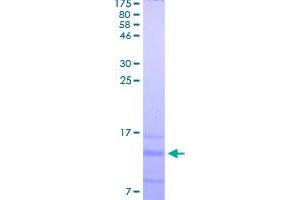 Image no. 1 for Chemokine (C-X-C Motif) Ligand 2 (CXCL2) (AA 35-107) protein (His-DYKDDDDK-Strep II Tag) (ABIN4369869)