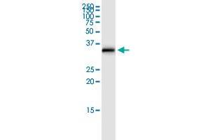 SULT1E1 (Human) IP-WB Antibody Pair