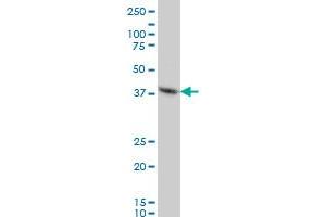 FOXF2 monoclonal antibody (M04), clone 2G10 Western Blot analysis of FOXF2 expression in HeLa .