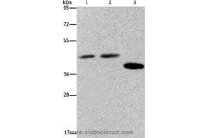 Western blot analysis of Hela, 293T and LO2 cell, using SERPINB3 Polyclonal Antibody at dilution of 1:400 (SERPINB3 anticorps)