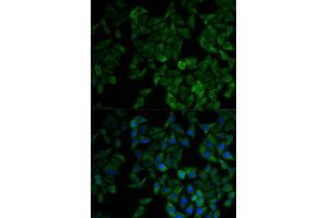Immunofluorescence analysis of HeLa cell using TNFRSF1A antibody. (TNFRSF1A anticorps  (AA 22-211))