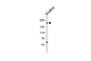 Western blot analysis of lysate from mouse kidney tissue lysate, using Erbb2 Antibody  (ABIN6243606 and ABIN6577675).
