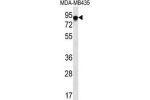 Western Blotting (WB) image for anti-FYN-Binding Protein (FYB) antibody (ABIN2996649) (FYB anticorps)