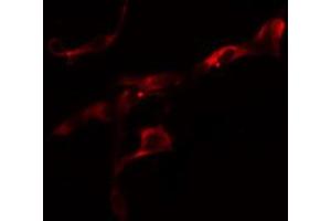 ABIN6274624 staining Hela cells by IF/ICC. (COL6A2 anticorps  (Internal Region))