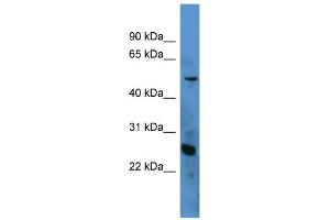 WB Suggested Anti-C1QA Antibody Titration: 0. (C1QA anticorps  (N-Term))