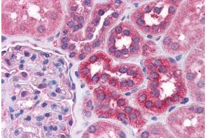 Anti-STAT6 antibody IHC staining of human kidney.