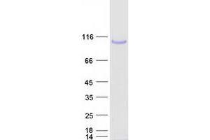 Validation with Western Blot