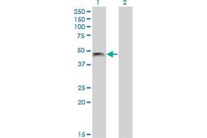 Western Blot analysis of PHF7 expression in transfected 293T cell line by PHF7 monoclonal antibody (M13), clone 3F3. (PHF7 anticorps  (AA 258-357))