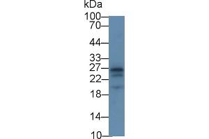 Detection of APOA1 in Rat Cerebrum lysate using Monoclonal Antibody to Apolipoprotein A1 (APOA1) (APOA1 anticorps  (AA 122-267))