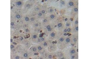Used in DAB staining on fromalin fixed paraffin- embedded Kidney tissue (Poliovirus Receptor anticorps  (AA 22-255))