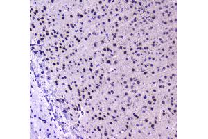 IHC analysis of RUNX1T1/ETO using anti-RUNX1T1/ETO antibody .