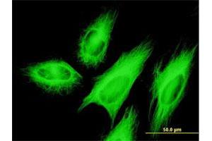 Immunofluorescence of monoclonal antibody to TUBB2A on HeLa cell. (TUBB2A anticorps  (AA 1-445))
