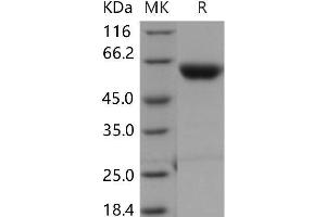 Western Blotting (WB) image for Carboxypeptidase B2 (Plasma) (CPB2) protein (His tag) (ABIN7320093) (CPB2 Protein (His tag))